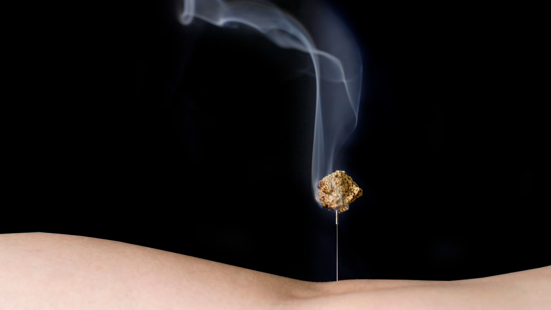close-up-moxibustion-needle