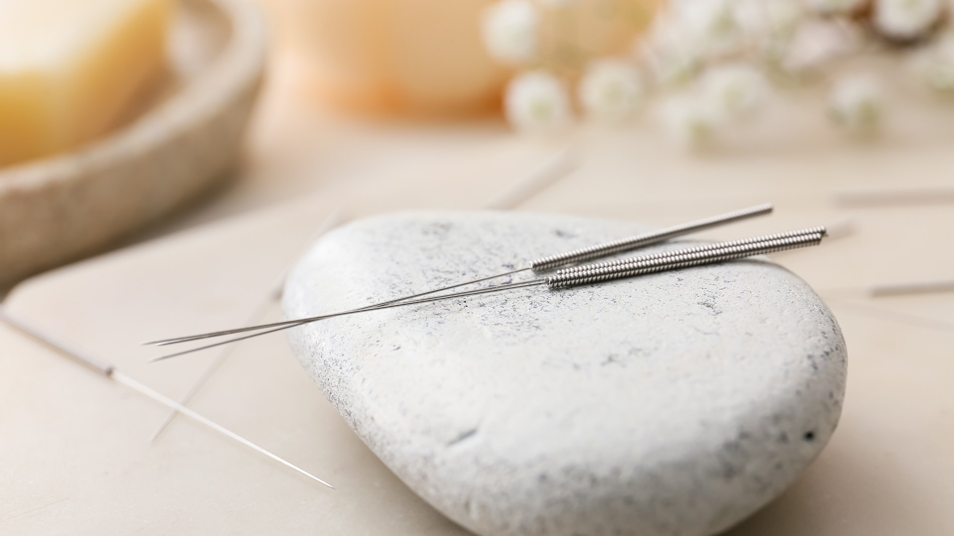 acupuncture