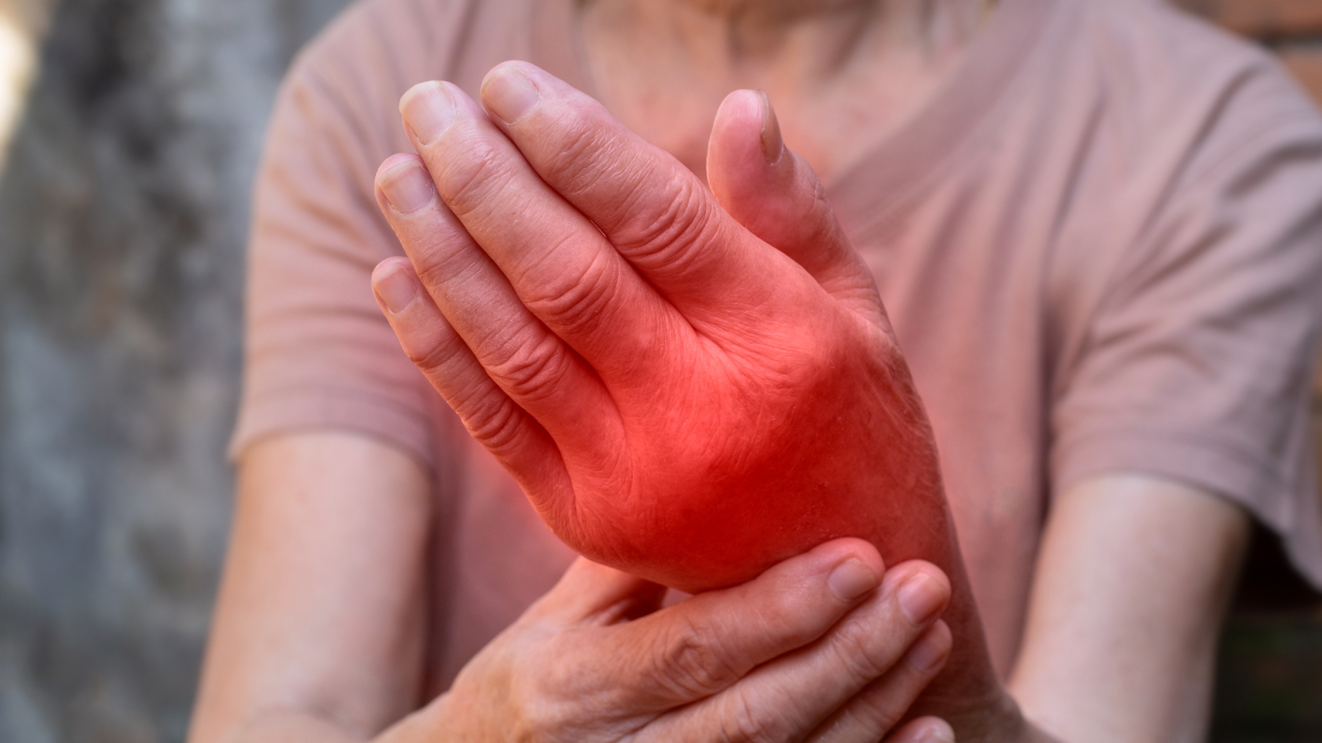 gout-on-hand