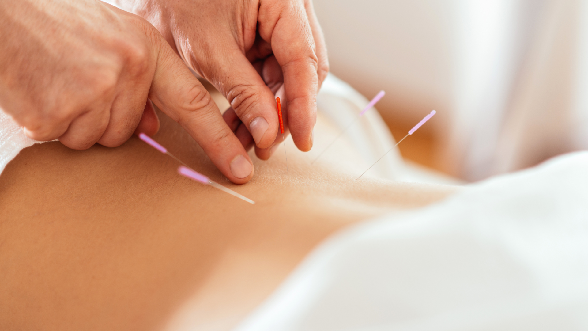 acupuncture-points
